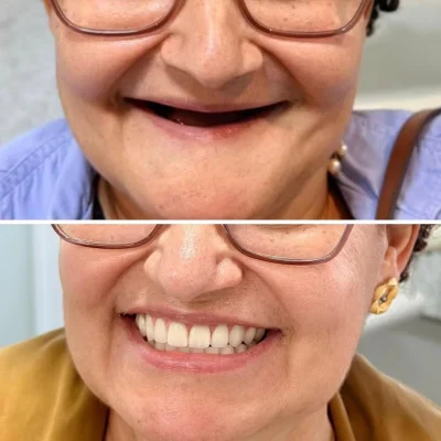 whatsapp_image_2025_12_22_at_17_42_04_1__1x